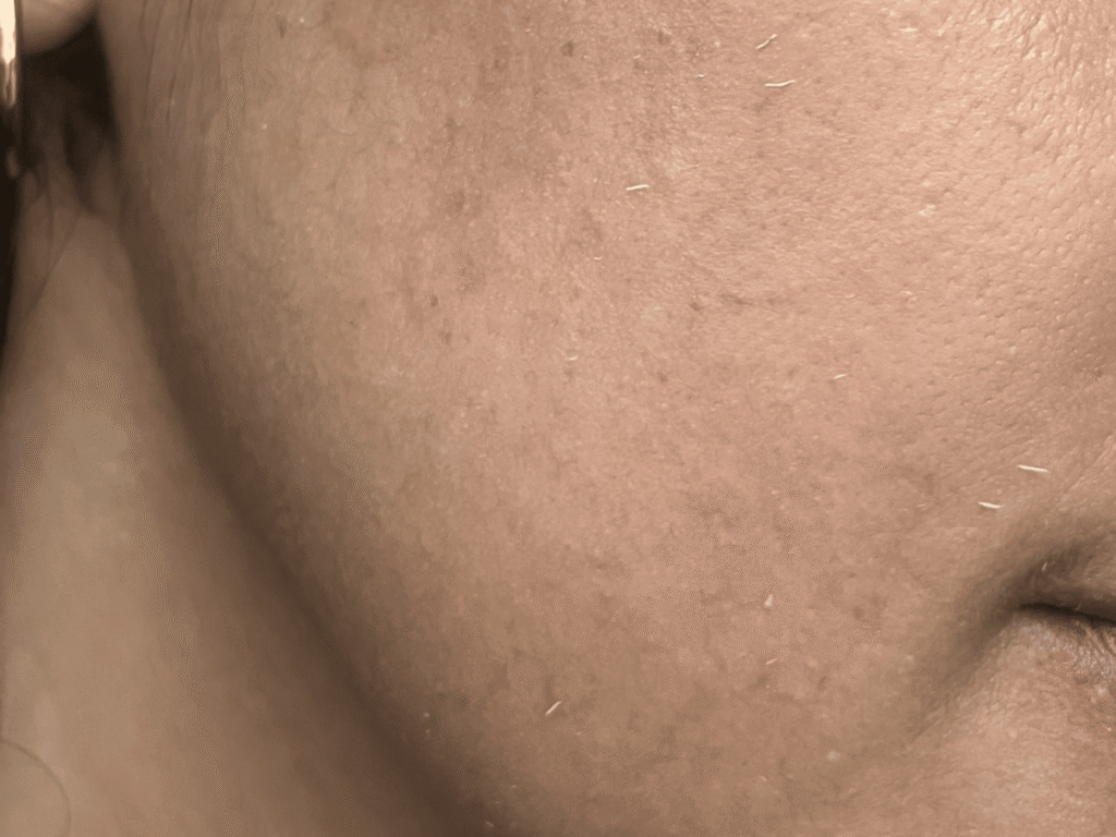 Small flakes forming on the cheek after rubbing NIVEA Protect & Light Feel Sun Serum into the skin.