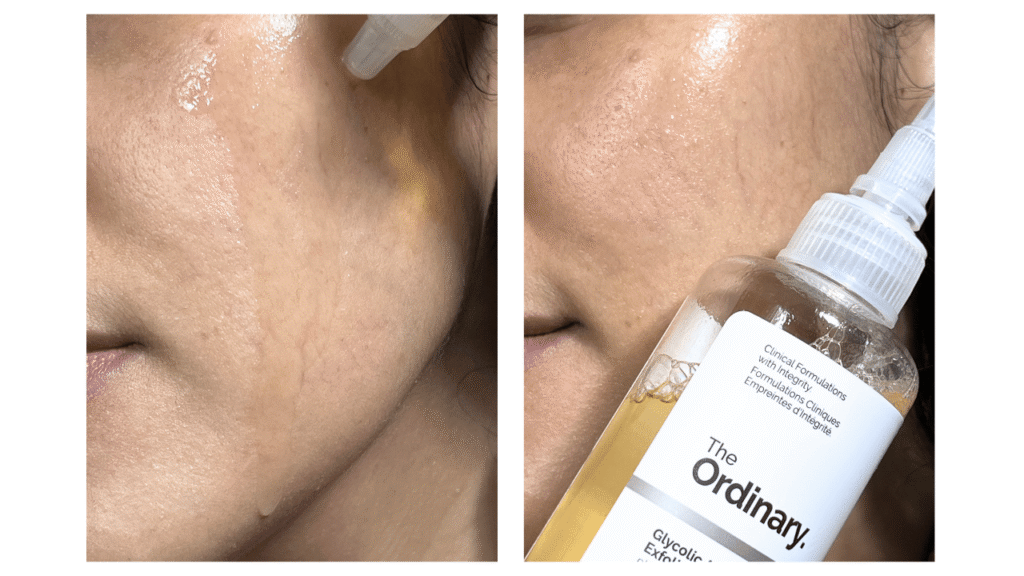 The Ordinary Glycolic Acid 7% Exfoliating Toner applied on the skin, showing its watery texture, lightweight consistency, and glowy finish after application.