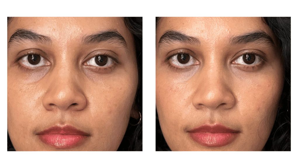 Close-up before and after transformation of under-eye circles using Kosas Revealer Concealer in shade 03W.